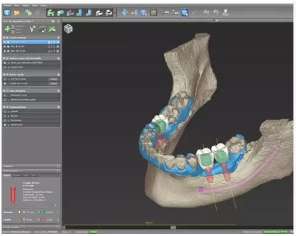 CAD/CAM системы и стоматология